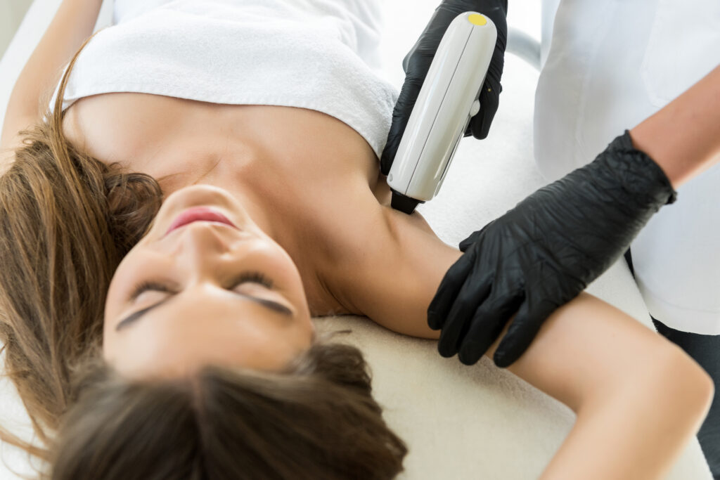 Laser hair Removal, DIolazexl laser hair removal